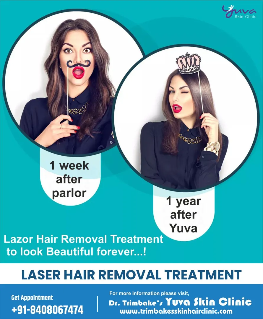 Tired of visiting the parlour every month? Get rid...