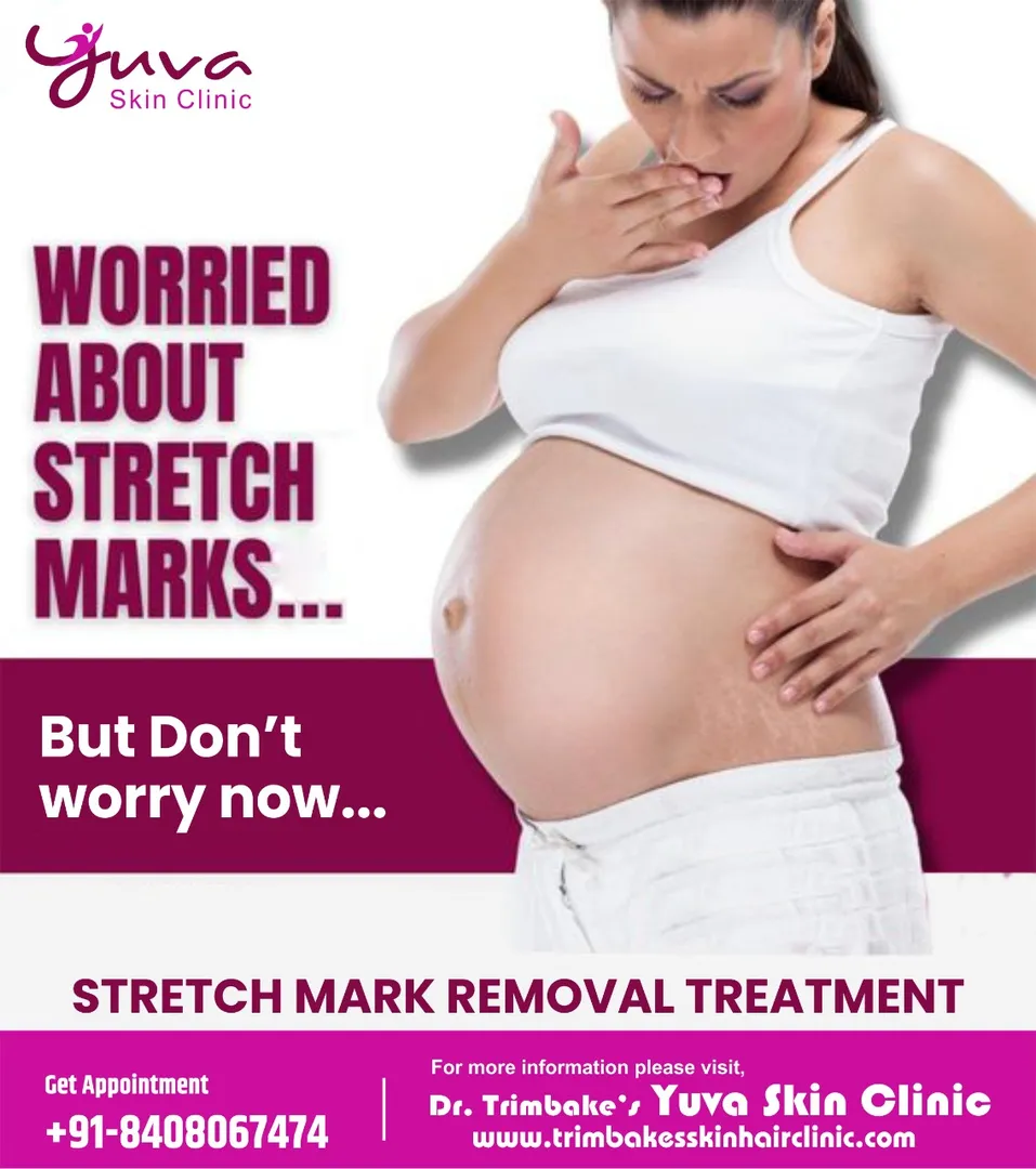 stretch Mark Removal Treatment
Stretch marks are v...