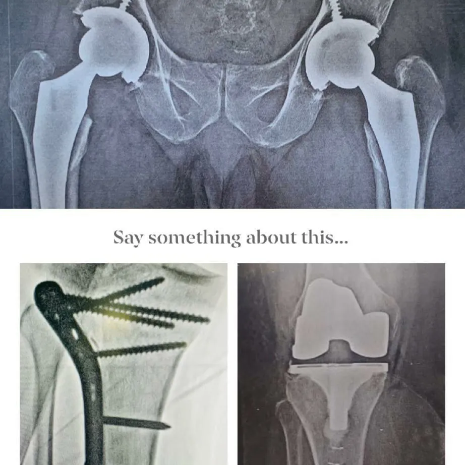 # Robotic Knee surgery
complicated trauma surgery...