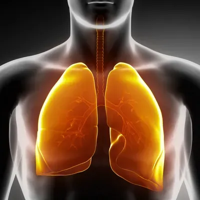 #InterstitialLungDisease #ILD
Interstitiallung di...
