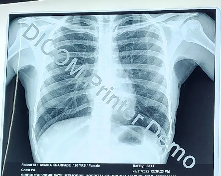 DICOM, or Digital Imaging and Communications in Me...