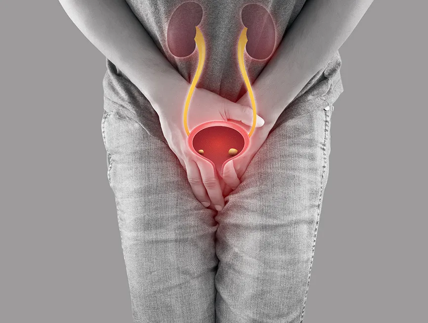 Urinary incontinence
the loss of bladder control ...