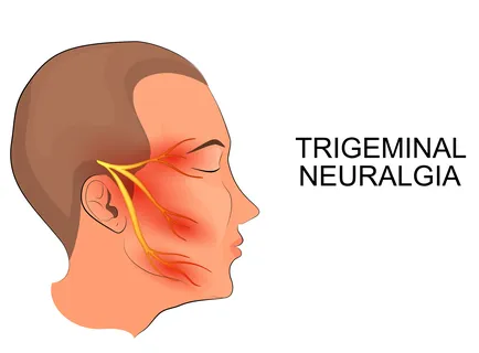 Do you want to visit Nonsurgical Treatment of Trig...