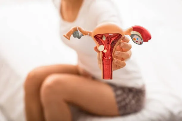 Diet for endometriosis
It’s difficult for most pe...