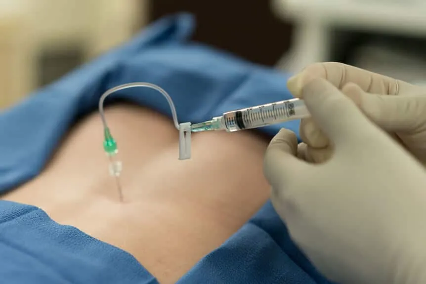What is epidural steroid injection?
Our spine (als...