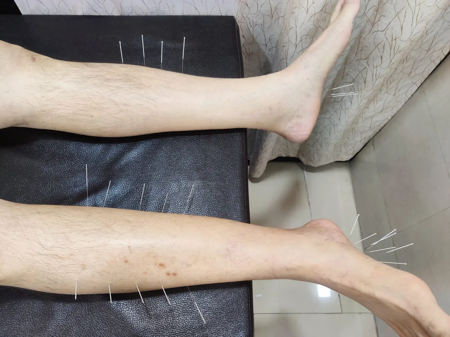 If painful neuropathy symptoms are affecting your ...