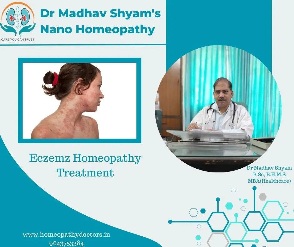 Eczema is a chronic inflammatory, non-contagious c...