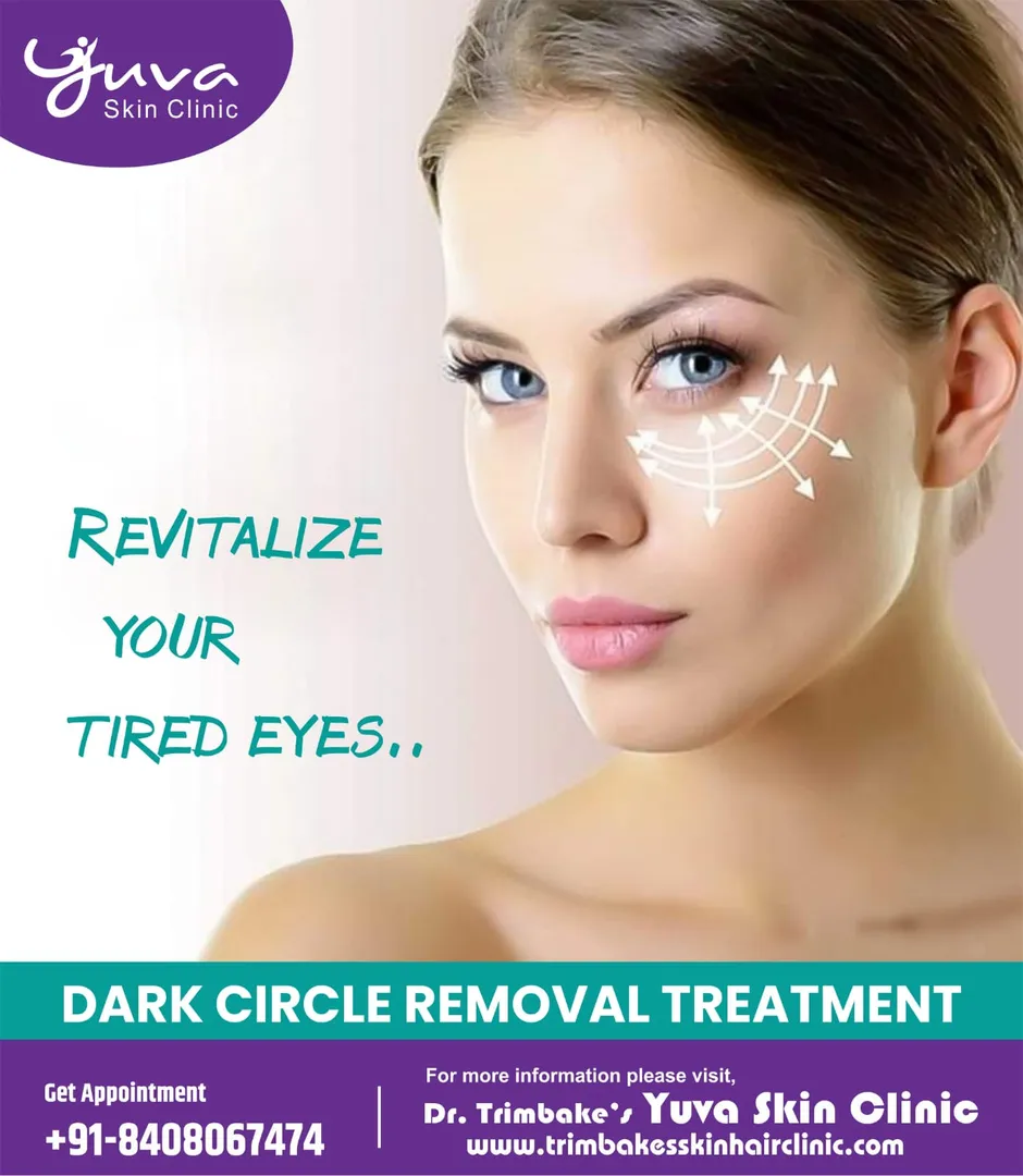 Dark circle removal treatment
Eyes are one of the...