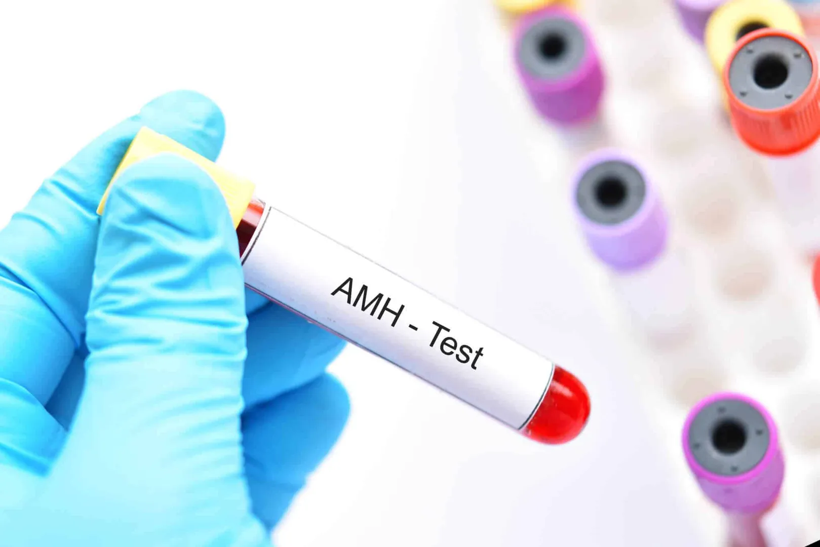 Anti-Mullerian Hormone Test OVERVIEW| TEST DE...
