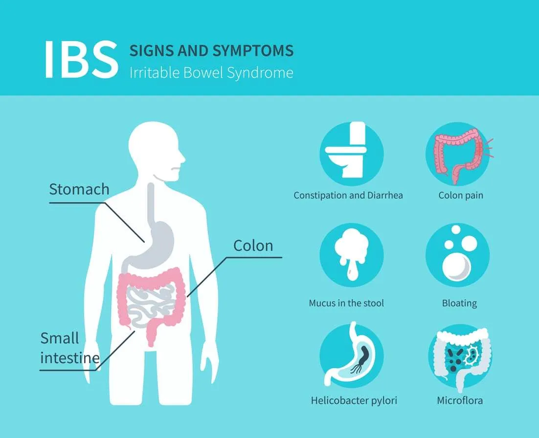 Irritable Bowel Syndrome (IBS)
...