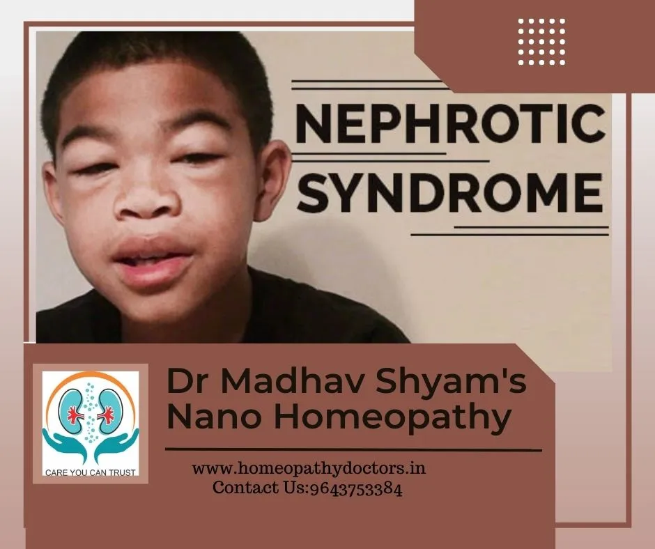 Nephrotic syndrome is a condition that causes the ...