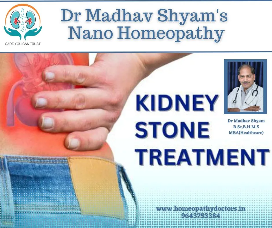 Kidney stone treatment in Dwarka by Dr Madhav Shya...