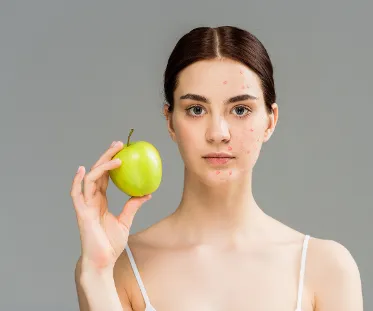 Eliminate acne with our comprehensive treatment pl...