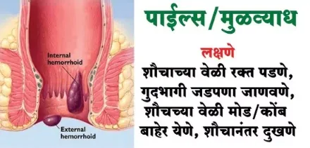 "Discover the Bliss of Relief: Dr. Phapale Hospita...