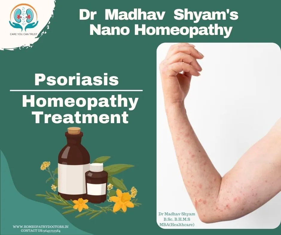 Homeopathy is suggested to be used as the first ch...