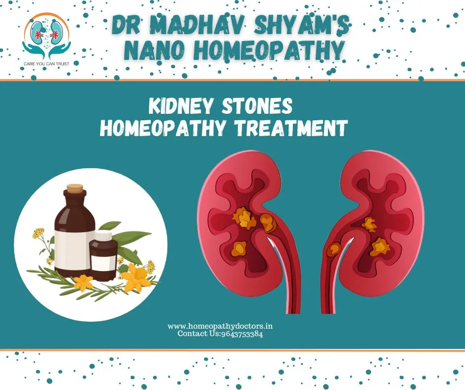 Kidney stone treatment in Dwarka by Dr Madhav Shya...