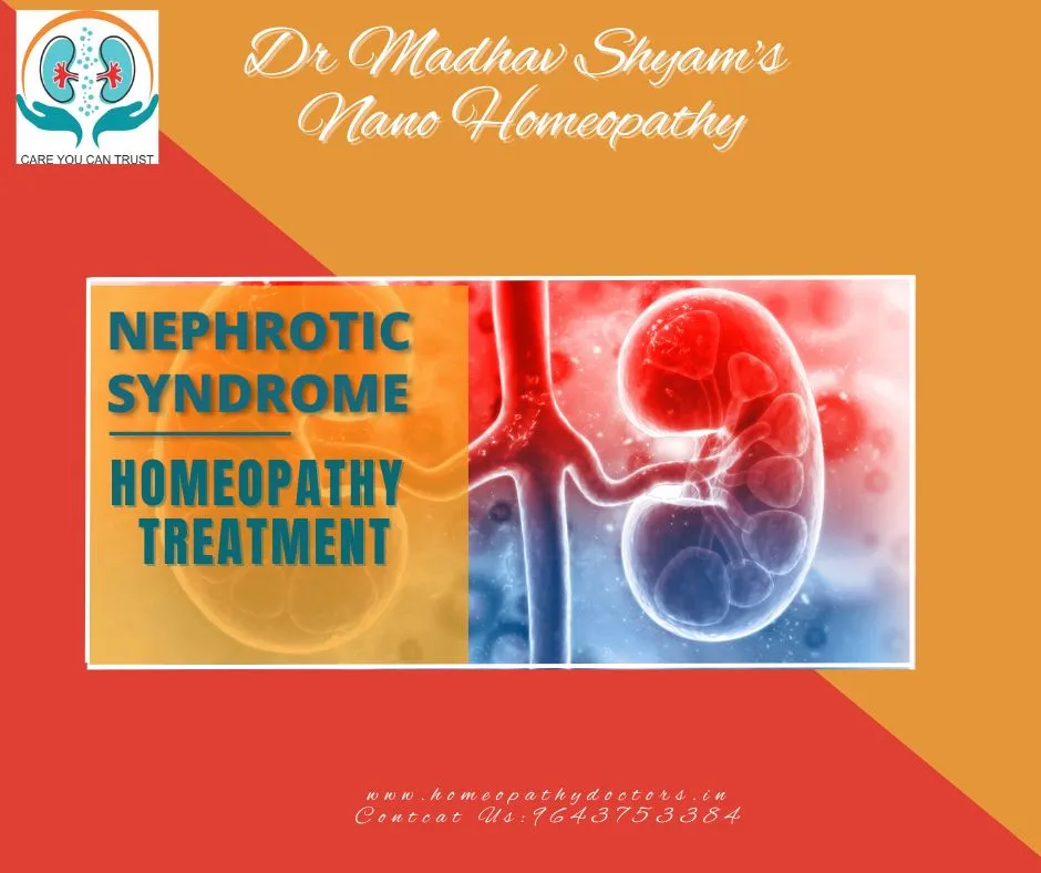 Nephrotic syndrome is a condition that causes the ...