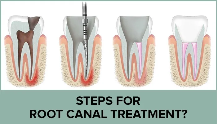 best dental clinic in gaur
PD Dental Clinic and ...