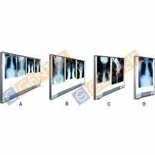 Led X-ray View Box
• A - For four film
• B - ...