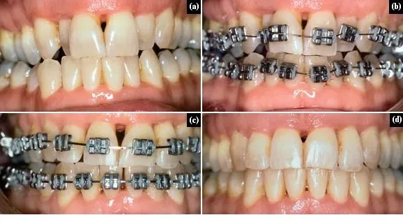 dentist near me
PD Dental Clinic and Implant Cen...