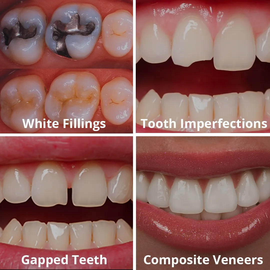 Dental Clinics in Noida Extension
Welcome to PD...