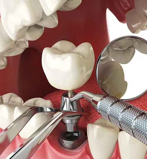top dentist in gaur city
PD Dental Clinic And I...