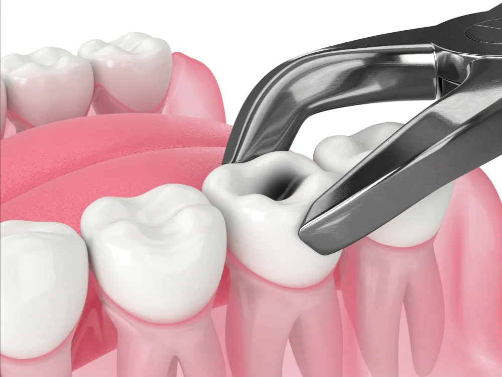 Dental Clinic in gaur city 2
At PD Dental Clinic...