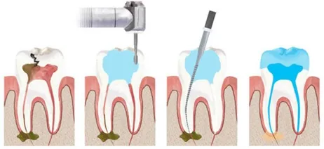 Best Dentists In Greater Noida West
PD Dental Cl...