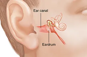 Do you required Tympanoplasty Clinic in Rahatani, ...