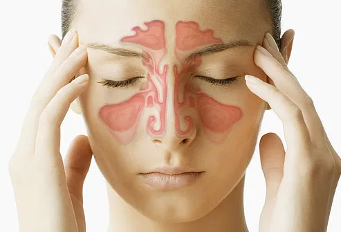 Get Sinusitis Treatment Clinic in Rahatani, Kalewa...