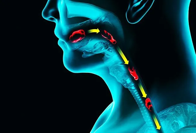 Finding Evaluation of Neck Swelling (Thyroid) Clin...
