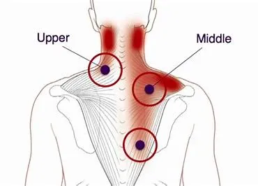 Trapezius is large flat muscle that extends from u...