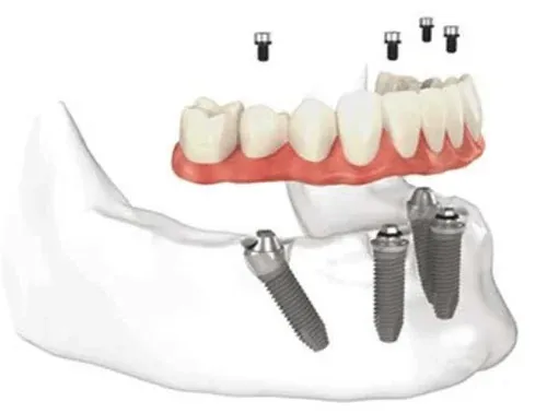 Best Dentists In Gaur City, Noida
Welcome to P.D. ...