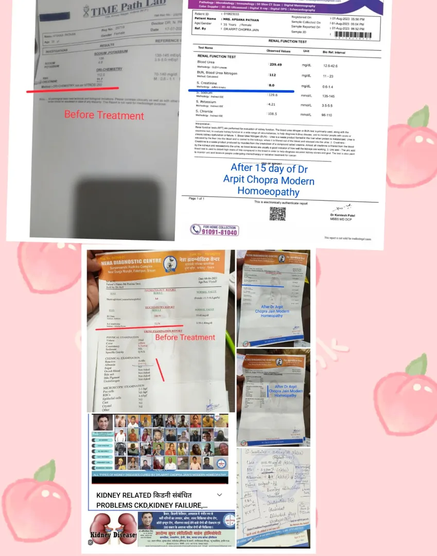 Chronic Kidney Disease CKD High Creatinine 11.7 to...