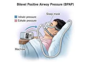 What is BiPap? Some medical problems can make it h...