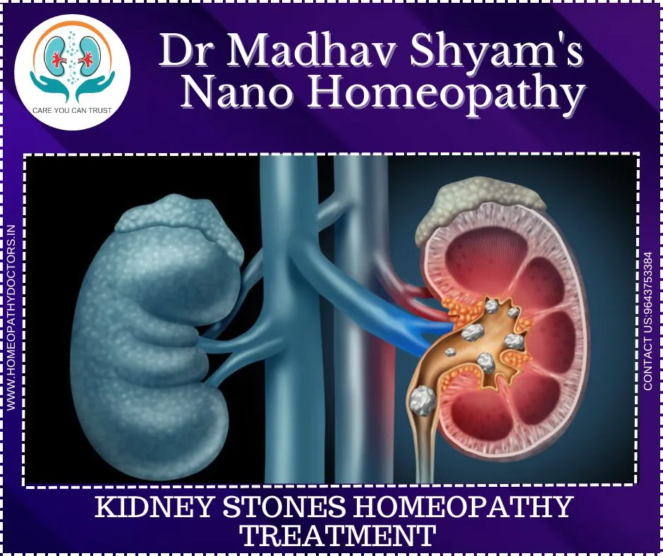 Kidney stone treatment in Dwarka by Dr Madhav Shya...