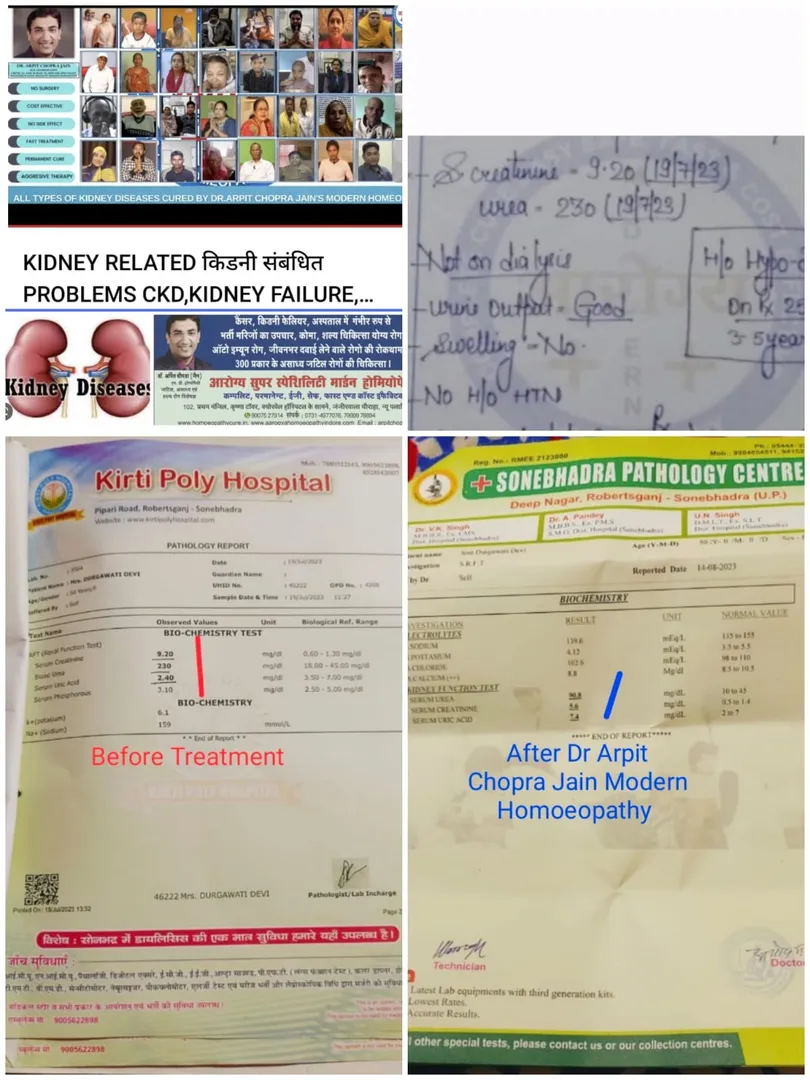 Kidney Failure with creatinine 9.2 to 5.6 by Dr Ar...