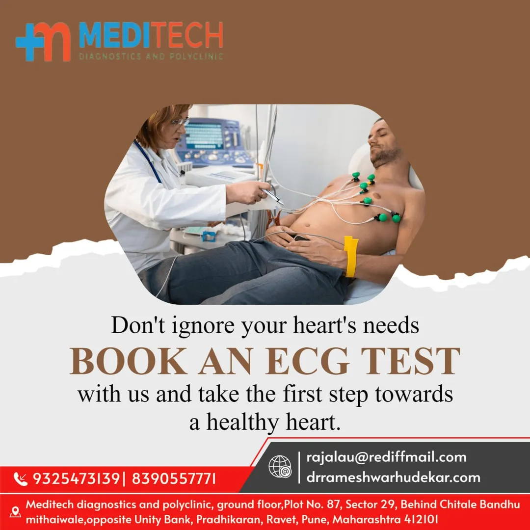 ECG helpful in diagnosing various problems of hear...