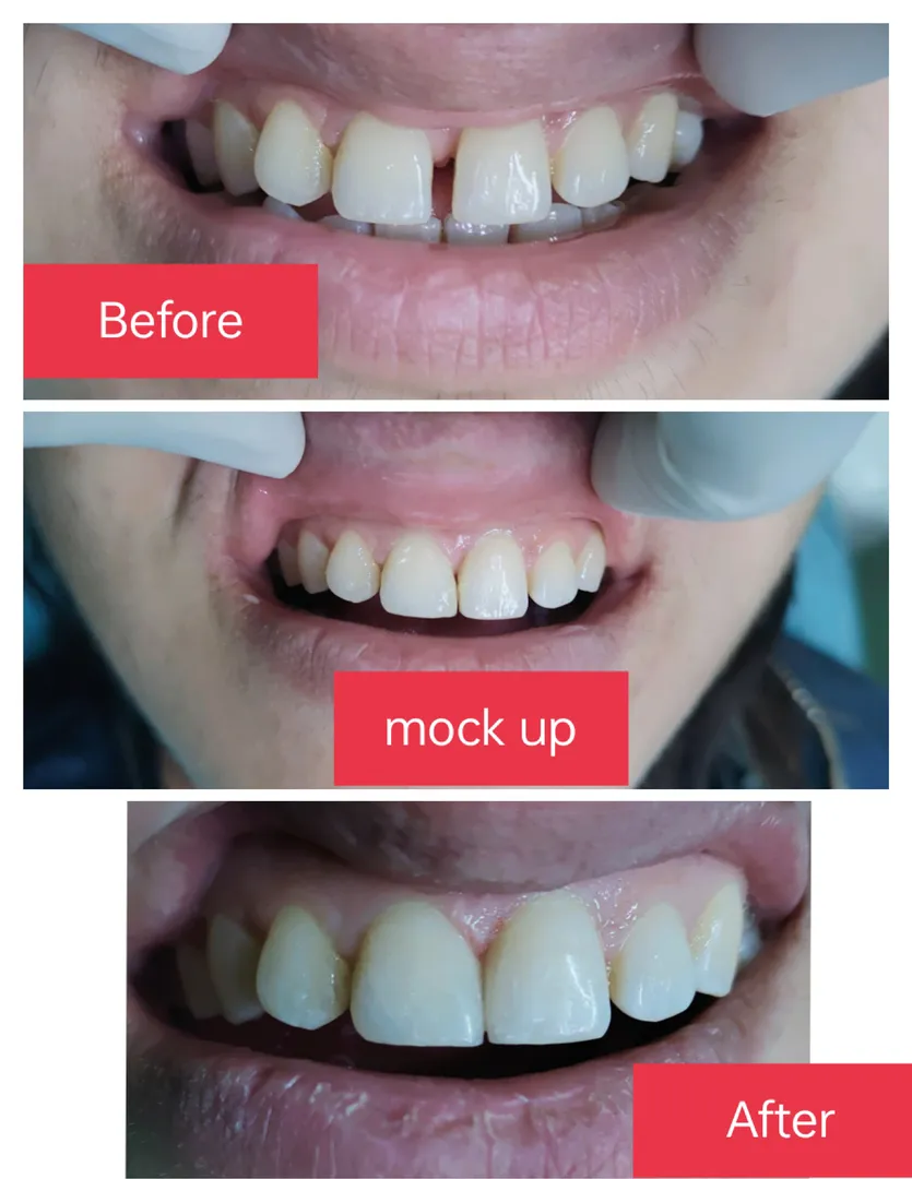 #"SmileMakeover #DentalCare #PD dental clinic & Im...