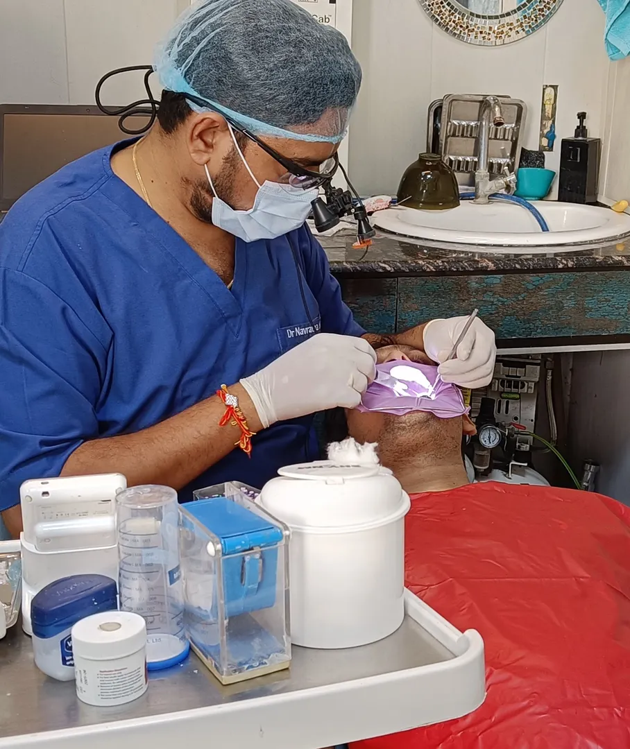 #rootcanaltreatment
#singlesittingrct
#endodontics...