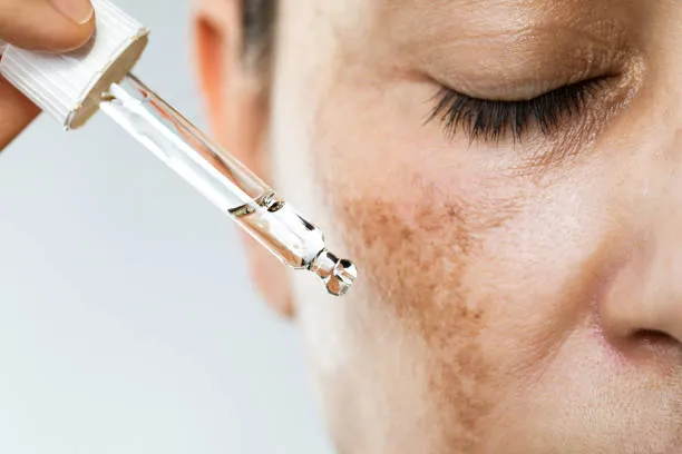 Discover Aesthetic Bliss at Nagpur's Pinnacle Skin...
