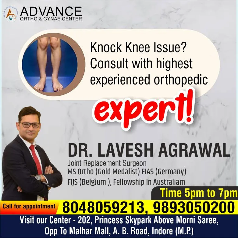 Best Orthopedic Specialist For Knock Knee Treatme...