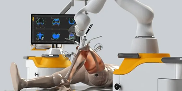 Non Robotic Joint Replacement
Conventional or popu...