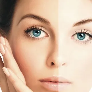 Skin Lightening in JanakPuri
Skin lightening is a...