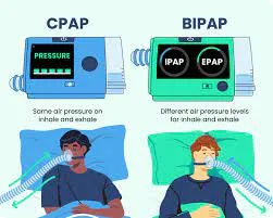 What is the difference between a CPAP and a BIPAP ...