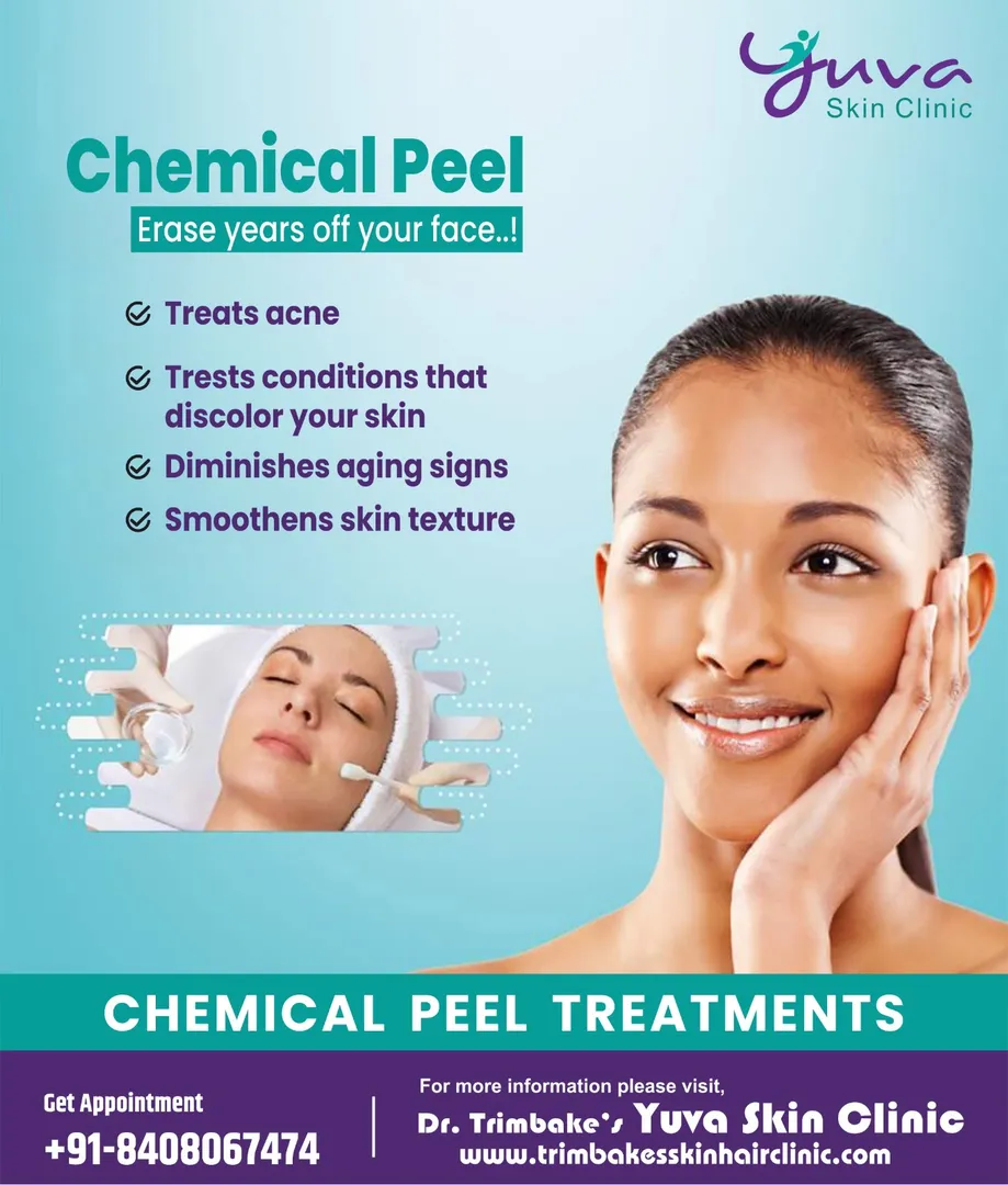 CHEMICAL PEELS
Chemical peels can treat the follow...