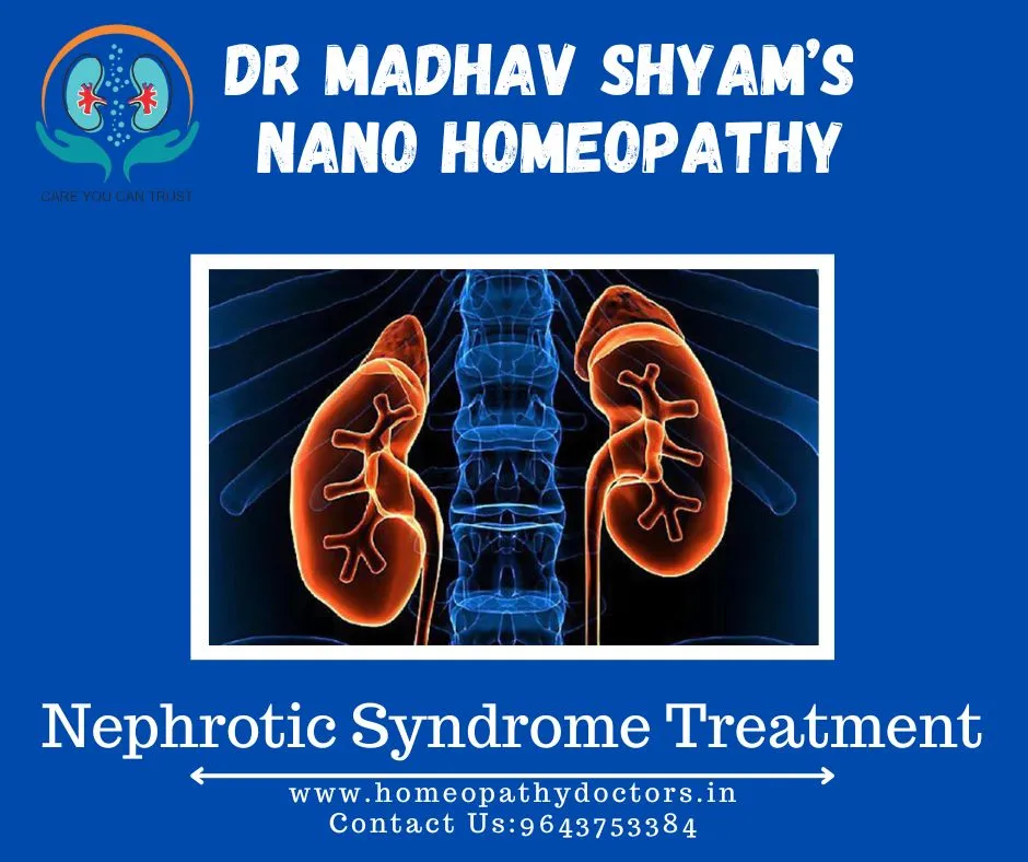 Nephrotic syndrome is a condition that causes the ...