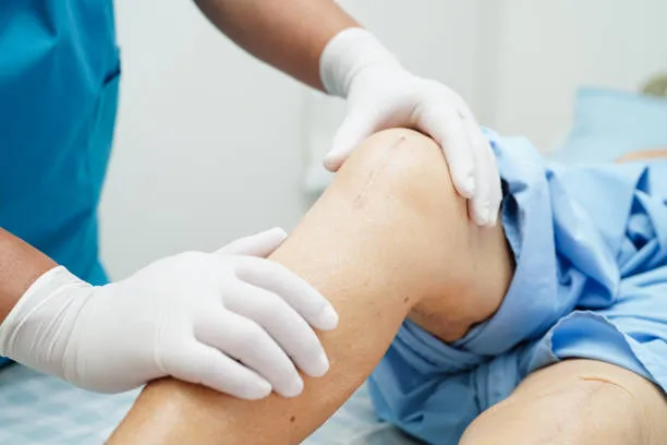 Best Doctor for Knee Replacement in Nashik Knee pa...