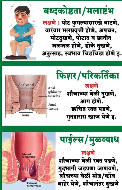 "Fissure Doctor at Dr. Phapale Hospital: Your Best...