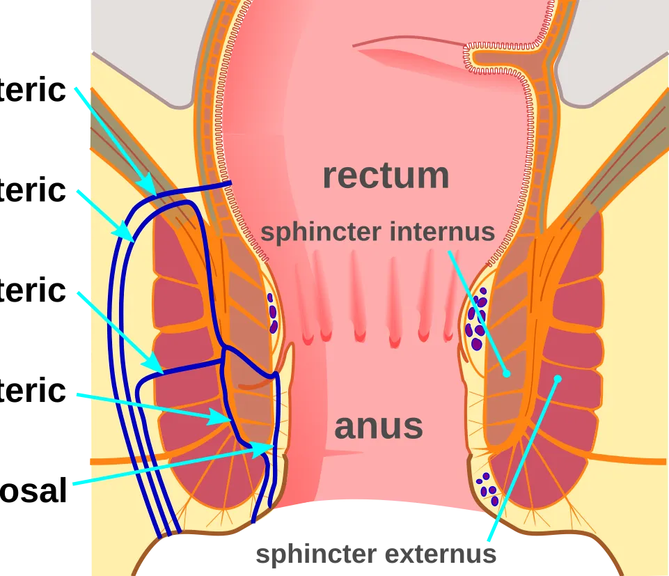 Fistula Causes:-
Most anal fistulas develop after ...